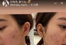 不化妆不行!ひなたまりん的脸坏掉了!-沐风文化